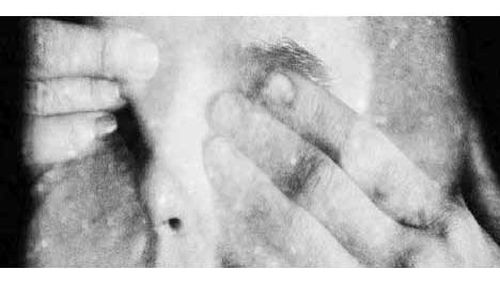 استیصال زیباشناختی یک تماشاگر تئاتر