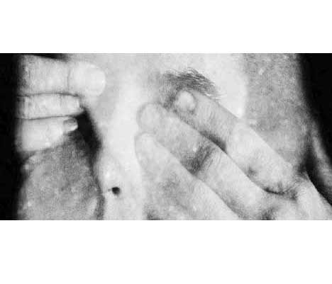 استیصال زیباشناختی یک تماشاگر تئاتر