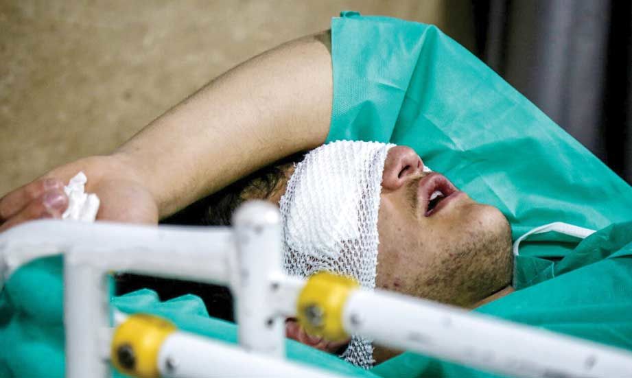 توضیح وزارت بهداشت درباره درمان آسیب‌دیدگان چشمی حوادث اخیر